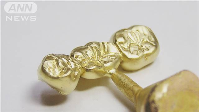 「金歯」窃盗か　歯科衛生士の女逮捕　兵庫
